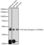 TGFBR1 Polyclonal Antibody
