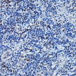 C/EBP beta Polyclonal Antibody
