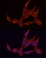 APAF1 Polyclonal Antibody