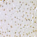 Ku70 Antibody in Immunohistochemistry (Paraffin) (IHC (P))