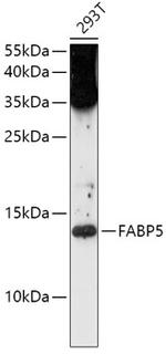 FABP5 Polyclonal Antibody