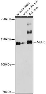 MSH6 Antibody in Western Blot (WB)