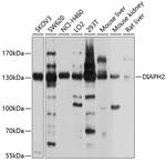 DIAPH2 Polyclonal Antibody