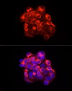 Cytokeratin 18 Polyclonal Antibody