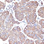 Cytokeratin 18 Antibody in Immunohistochemistry (Paraffin) (IHC (P))