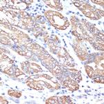 Cytokeratin 18 Antibody in Immunohistochemistry (Paraffin) (IHC (P))