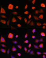 eIF2b epsilon Polyclonal Antibody