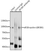eIF2b epsilon Antibody in Immunoprecipitation (IP)
