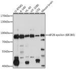 eIF2b epsilon Antibody in Western Blot (WB)