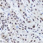 SRC2 Polyclonal Antibody