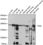 PLB1 Polyclonal Antibody