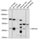 GPR143 Polyclonal Antibody