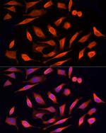 MST3 Antibody in Immunocytochemistry (ICC/IF)