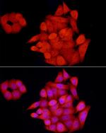 GCH1 Antibody in Immunocytochemistry (ICC/IF)