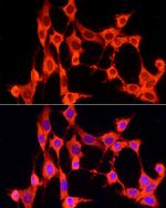 GCH1 Polyclonal Antibody