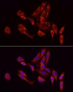 GCH1 Antibody in Immunocytochemistry (ICC/IF)