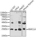 ZNF313 Polyclonal Antibody
