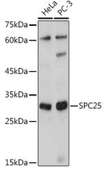 SPC25 Antibody in Western Blot (WB)