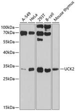 UCK2 Polyclonal Antibody