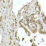 AKT1 Antibody in Immunohistochemistry (Paraffin) (IHC (P))