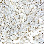 AKT1 Antibody in Immunohistochemistry (Paraffin) (IHC (P))