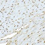 AKT1 Antibody in Immunohistochemistry (Paraffin) (IHC (P))