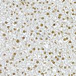 AKT1 Antibody in Immunohistochemistry (Paraffin) (IHC (P))