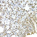 AKT1 Antibody in Immunohistochemistry (Paraffin) (IHC (P))