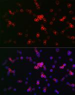 IRF3 Antibody in Immunocytochemistry (ICC/IF)