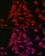 IRF3 Antibody in Immunocytochemistry (ICC/IF)