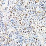 Vimentin Antibody in Immunohistochemistry (Paraffin) (IHC (P))