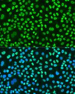 Histone H2A.X Antibody in Immunocytochemistry (ICC/IF)