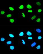 Histone H2A.X Antibody in Immunocytochemistry (ICC/IF)