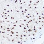 Histone H2A.X Antibody in Immunohistochemistry (Paraffin) (IHC (P))