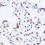 Histone H2A.X Antibody in Immunohistochemistry (Paraffin) (IHC (P))