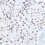 Histone H2A.X Antibody in Immunohistochemistry (Paraffin) (IHC (P))