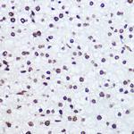 Histone H2A.X Antibody in Immunohistochemistry (Paraffin) (IHC (P))