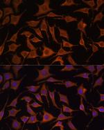 TNF alpha Polyclonal Antibody