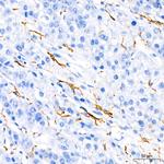 TNF alpha Antibody in Immunohistochemistry (Paraffin) (IHC (P))