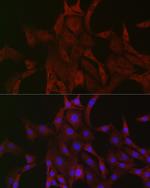 PAK4 Antibody in Immunocytochemistry (ICC/IF)