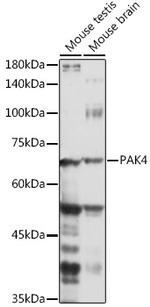 PAK4 Antibody in Western Blot (WB)