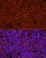 PYCARD Polyclonal Antibody
