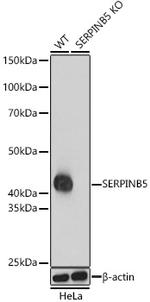 Maspin Polyclonal Antibody