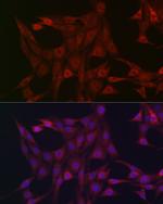 STAT3 Antibody in Immunocytochemistry (ICC/IF)