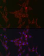 STAT3 Antibody in Immunocytochemistry (ICC/IF)