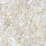 JAM-A (CD321) Polyclonal Antibody