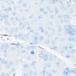 VE-cadherin Antibody in Immunohistochemistry (Paraffin) (IHC (P))