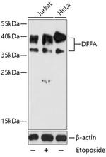 ICAD Polyclonal Antibody