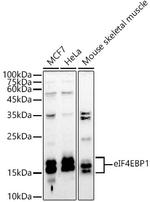 4EBP1 Polyclonal Antibody
