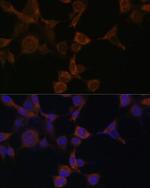 AMPK beta-1 Polyclonal Antibody